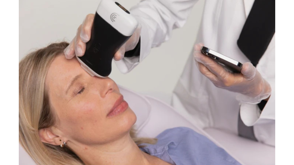 A doctor used Clarius to perform an imaging scan on a female patient's forehead