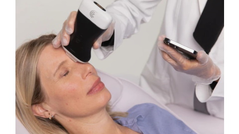 A doctor used Clarius to perform an imaging scan on a female patient's forehead