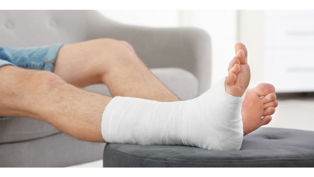 a leg with a cast resting on a ottoman