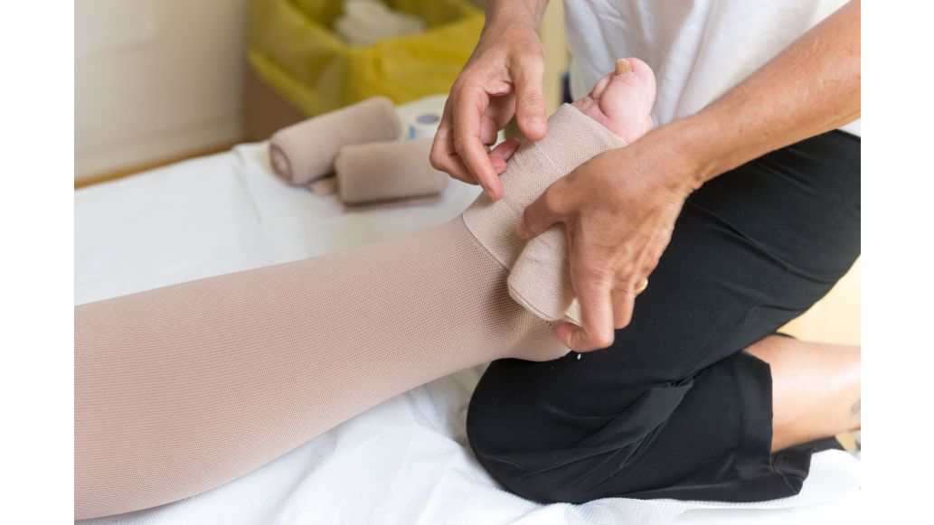 How is Lymphedema Different than Edema?