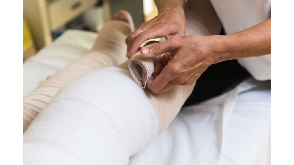 How to Reduce Lymphedema Swelling