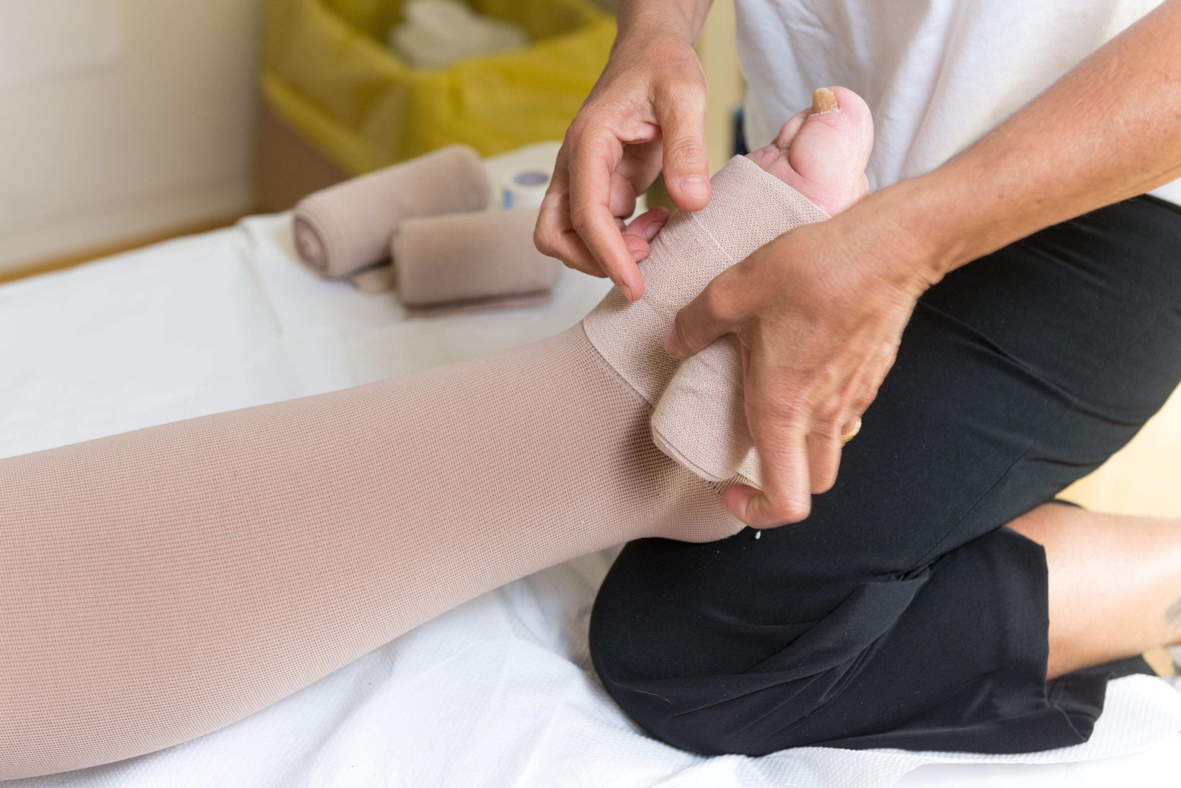 How is Lymphedema Different than Edema?
