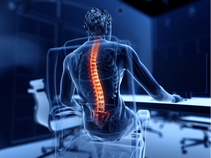 How to Treat Your Kyphosis: Exercises and Supports | Performance Health