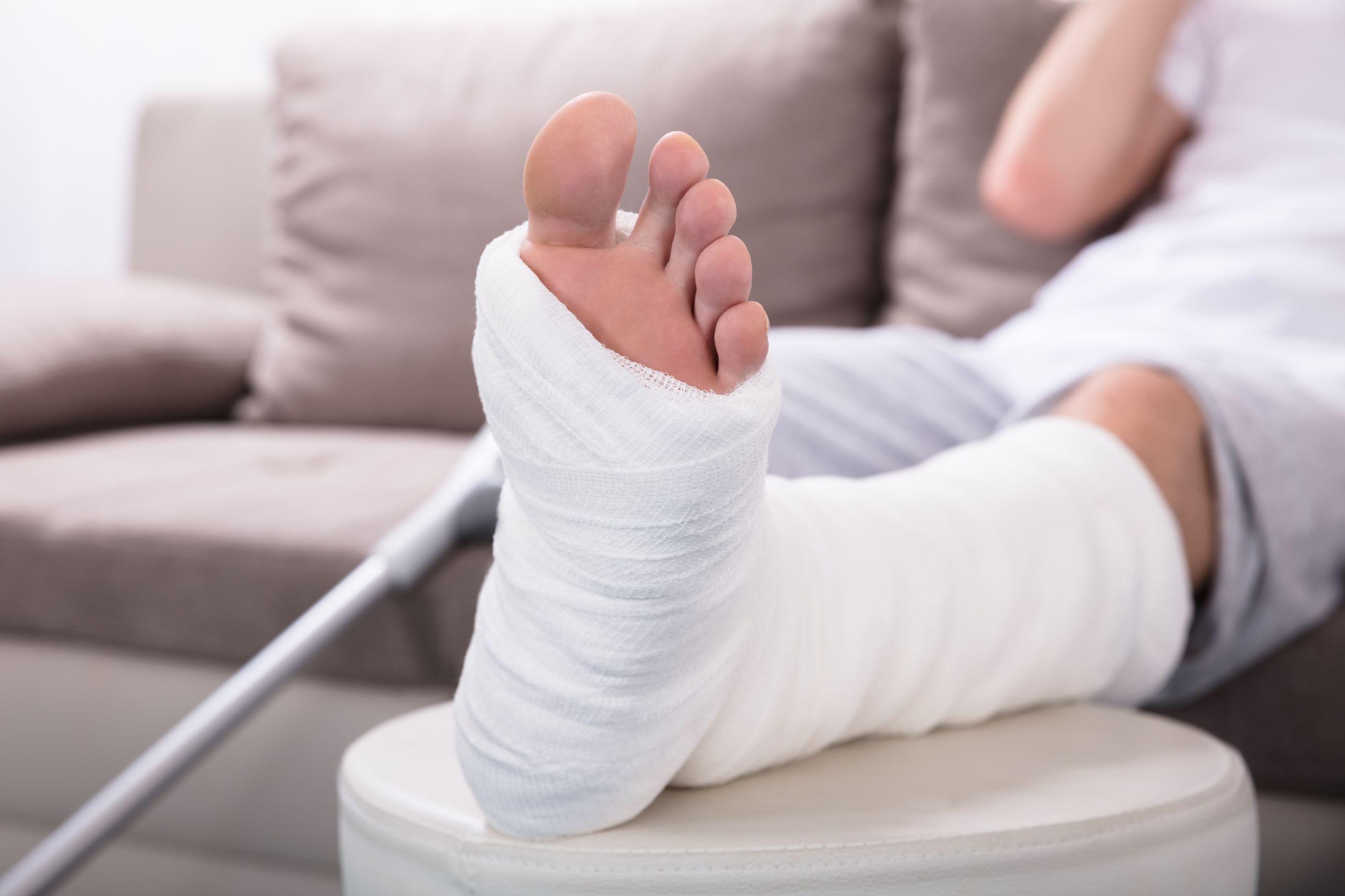 How to recover from a broken heel - Quora