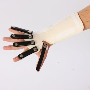 Robinson Forearm Radial Nerve Splint