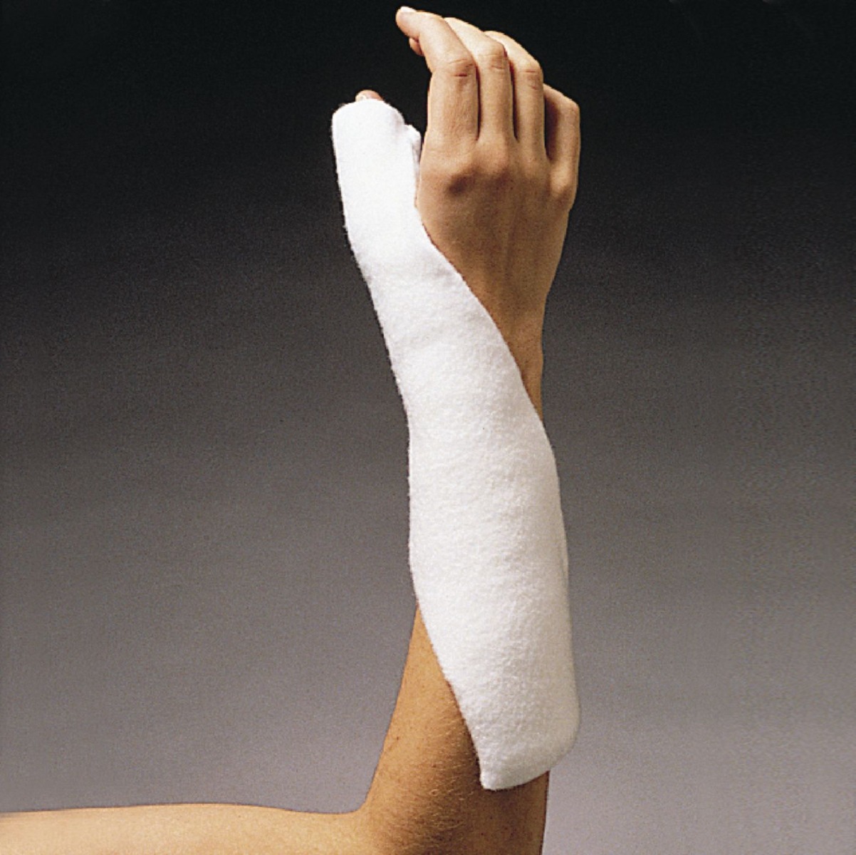 Ortho-Glass Splinting System