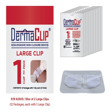 DermaClip Non-Invasive Skin Closure