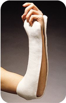 Ortho-Glass Splinting System