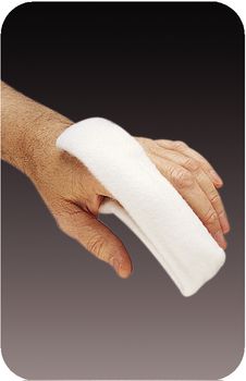 Ortho-Glass Splinting System