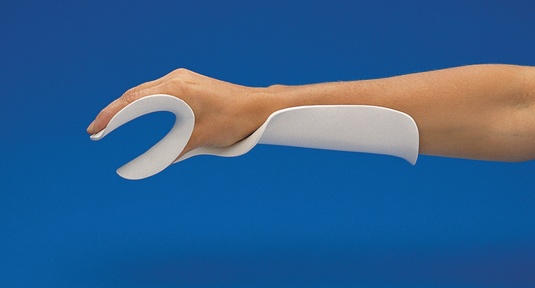Functional Hand Splint DynaPro™ Flex Hand | Buchanan Orthotics