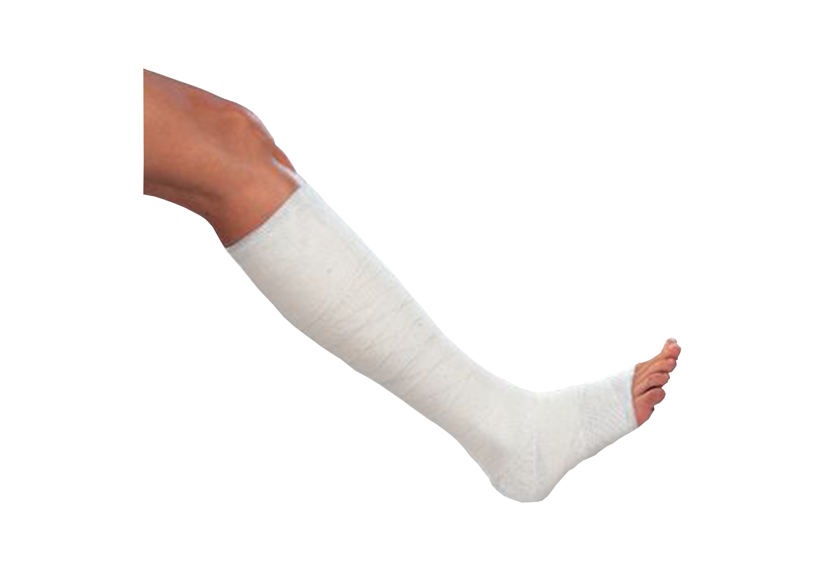 Unna's Boot Varicex Zinc Paste Bandages