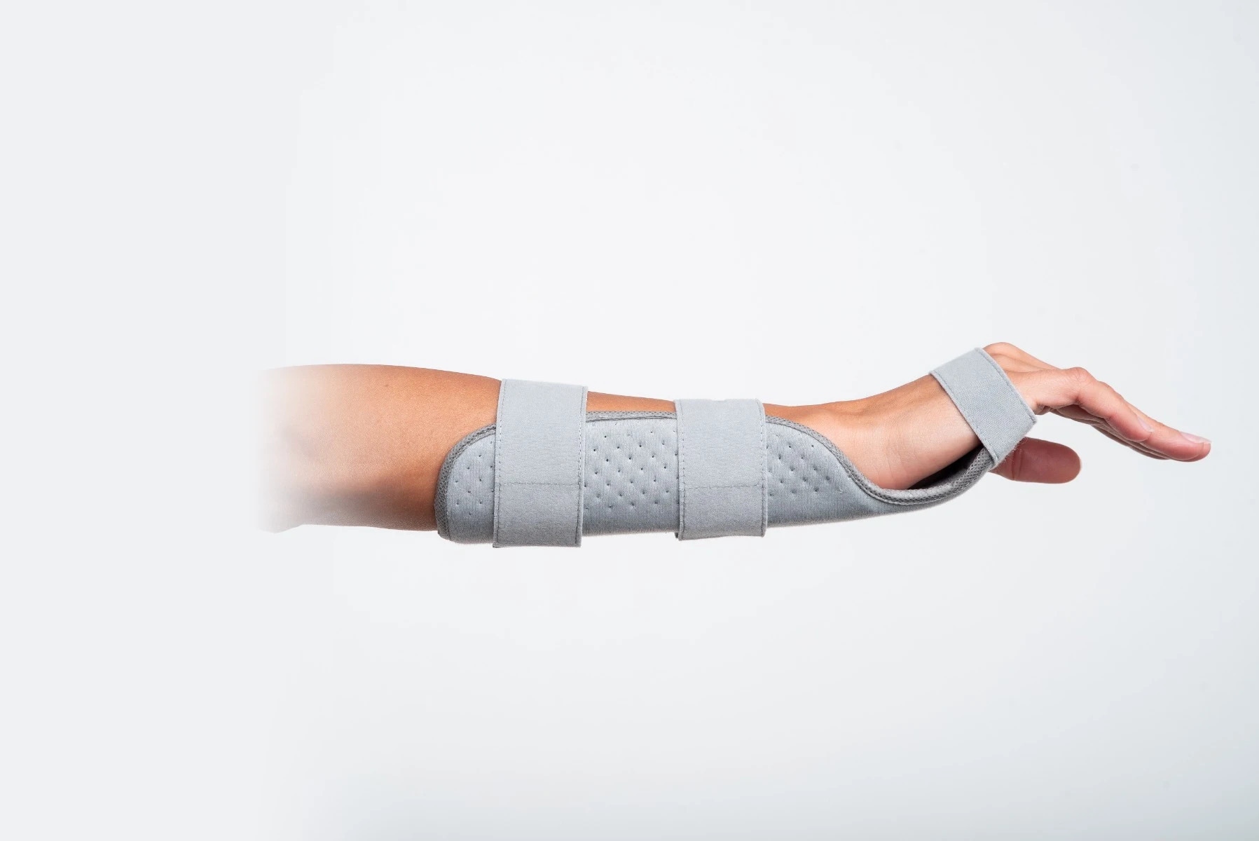 Chrisofix Volar Wrist Orthosis - In use, Side View
