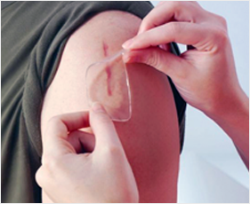 Scar Management