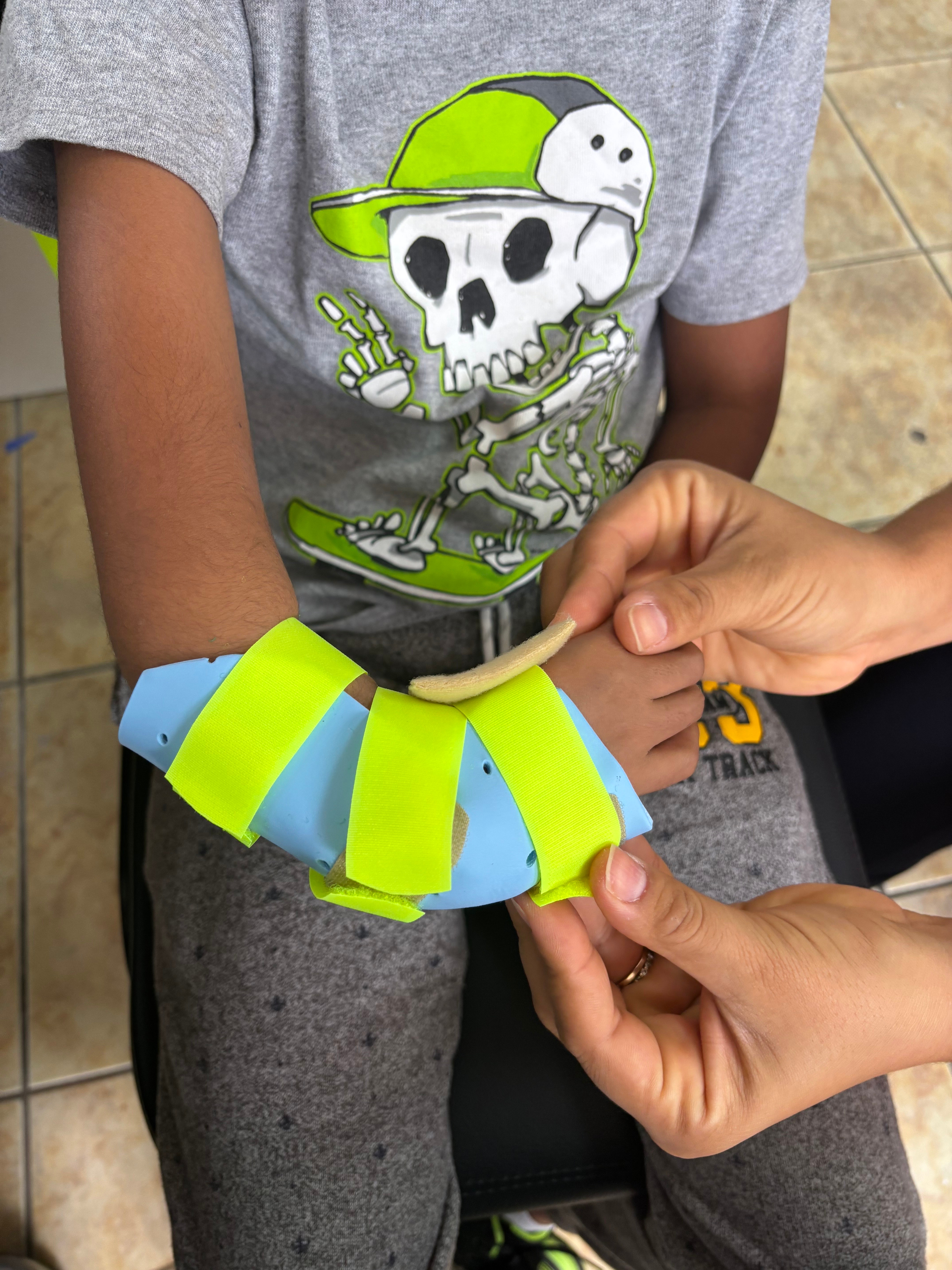 pediatric arm splint