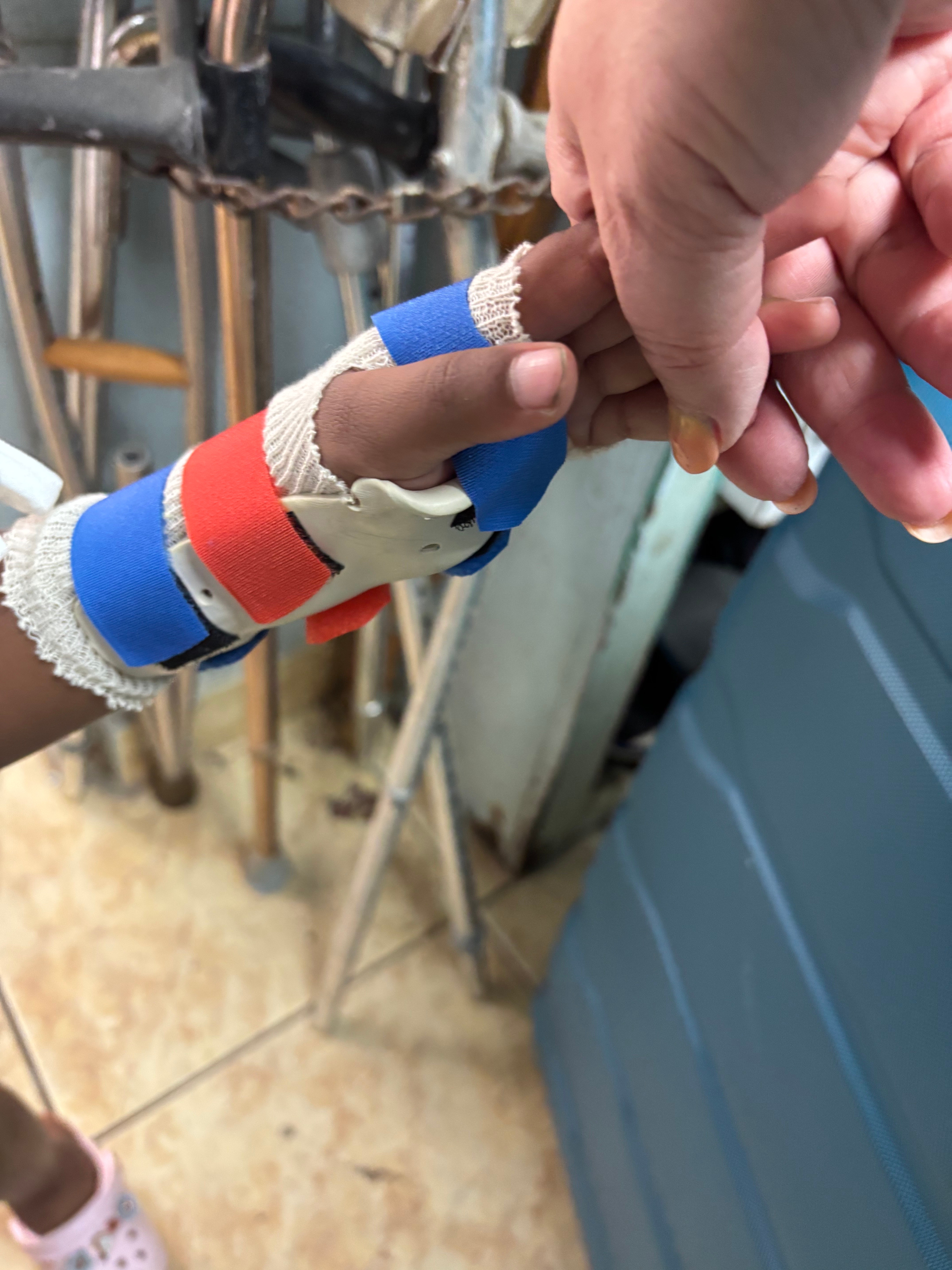 pediatric hand splint with straps
