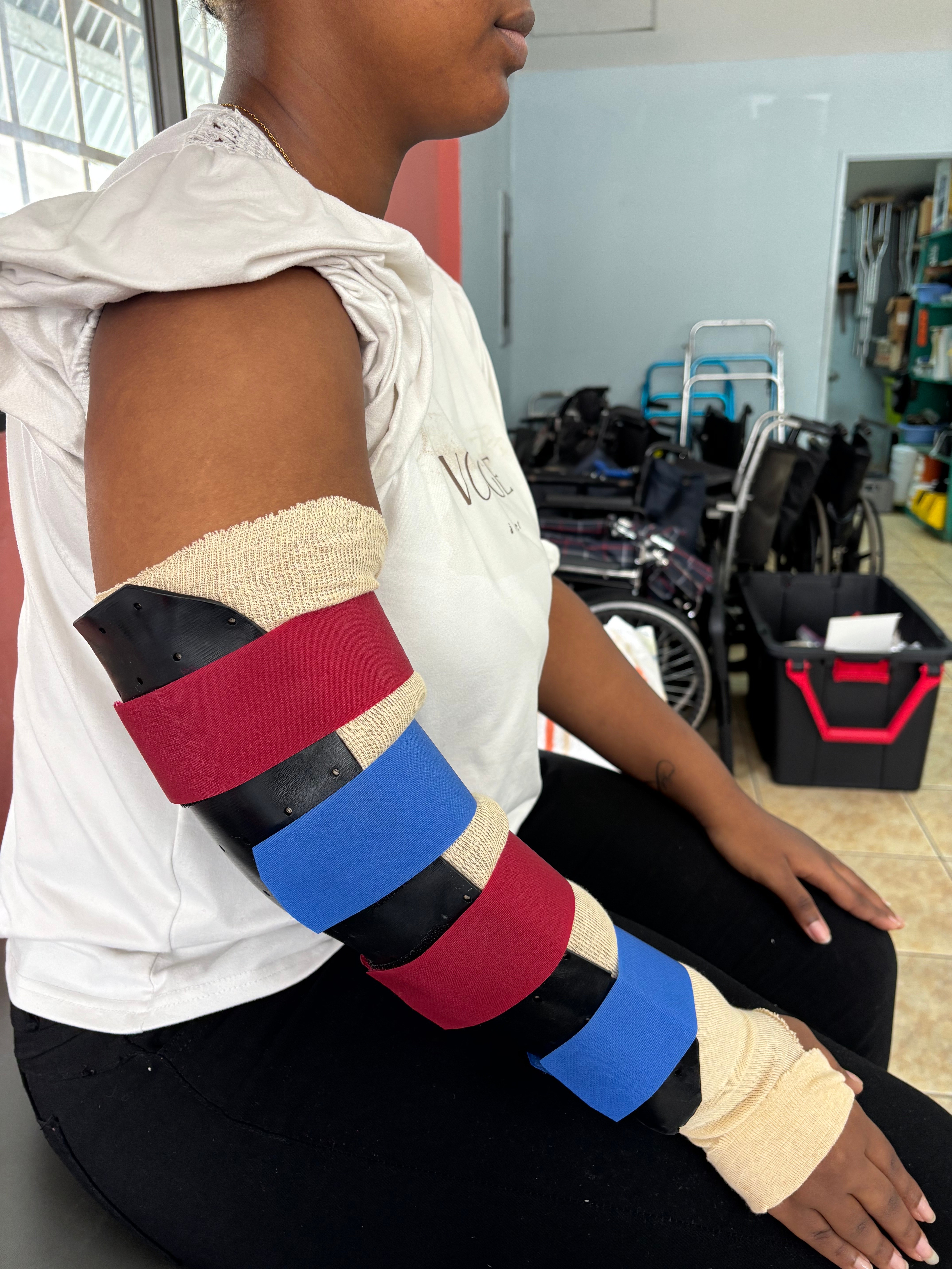 full arm splint
