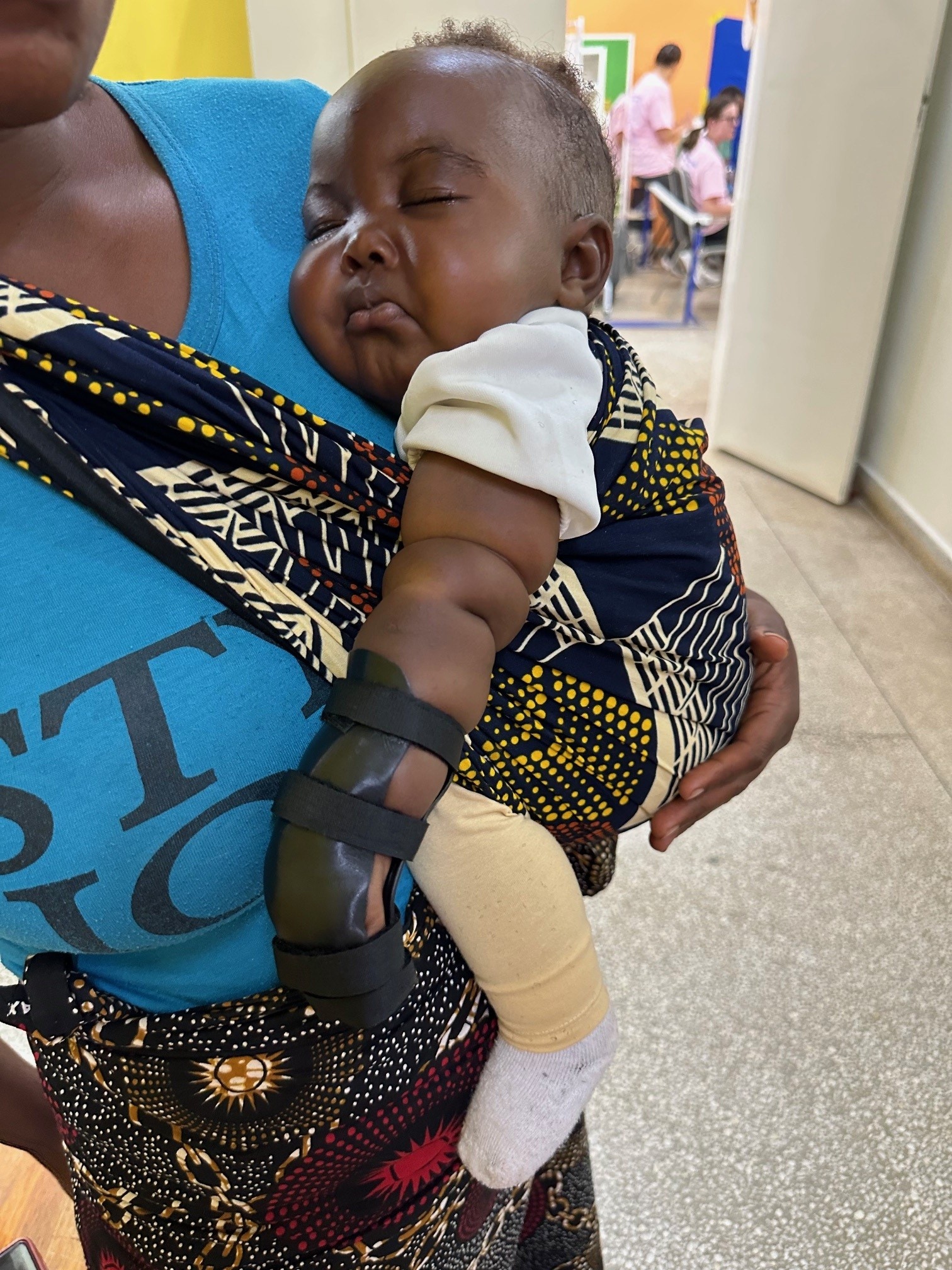 baby with hand splint