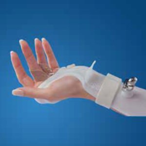 Static Progressive Splint