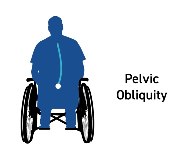 Wheelchair Eye Level