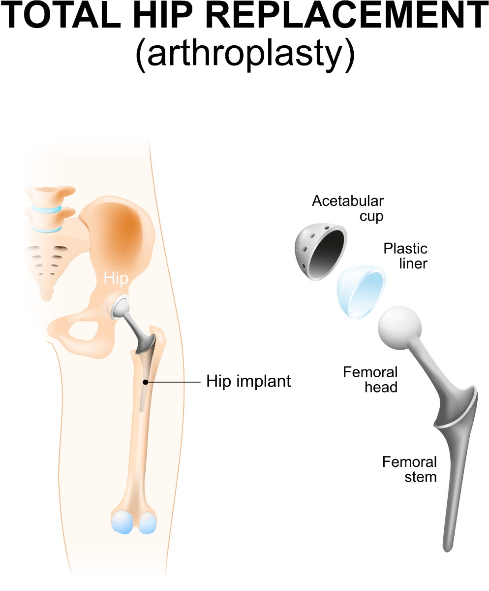 https://www.performancehealth.com/media/wysiwyg/blog/articles/hip-diagram.png