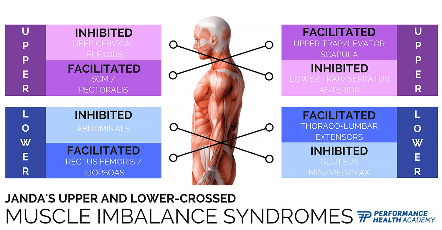 lower crossed syndrome table
