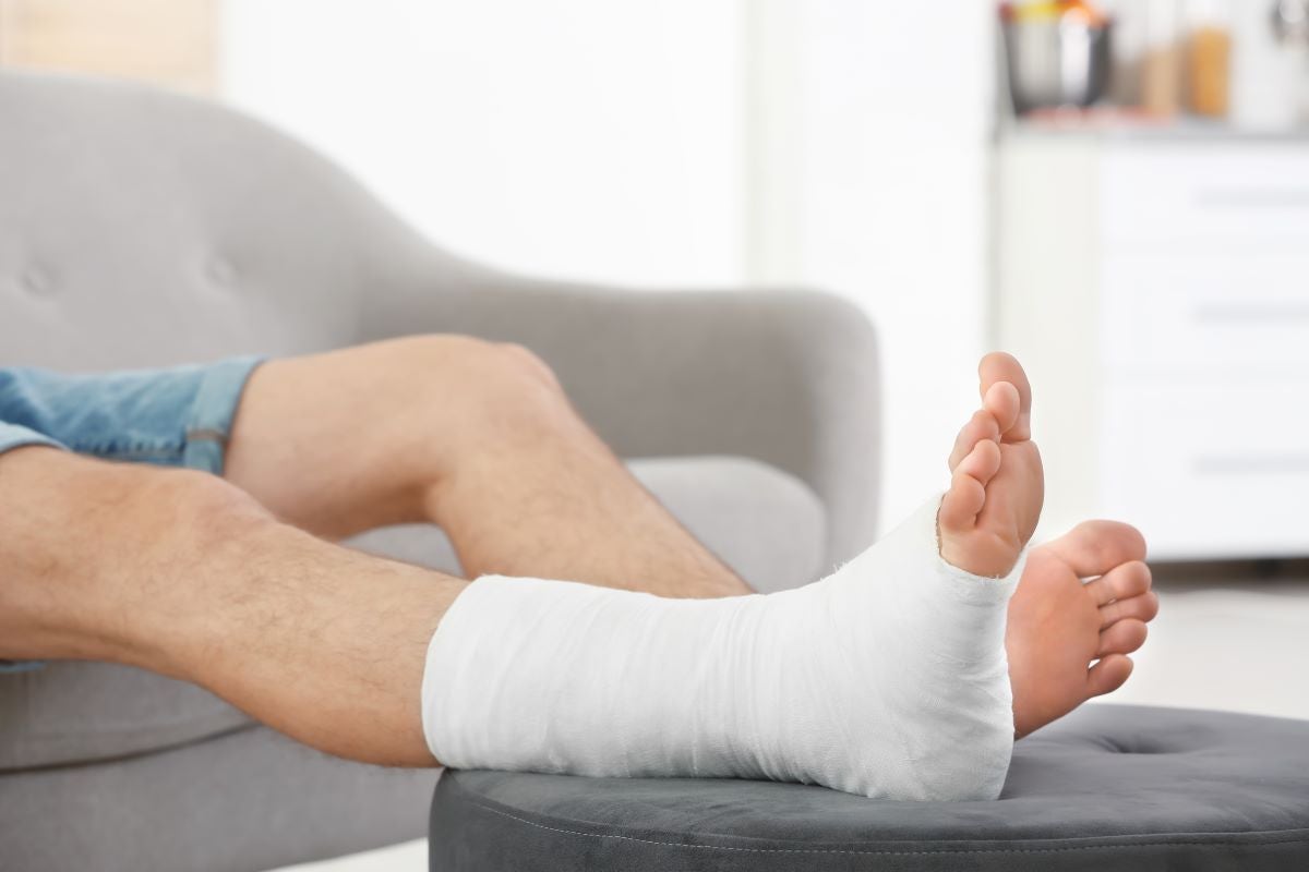 cast on foot and ankle