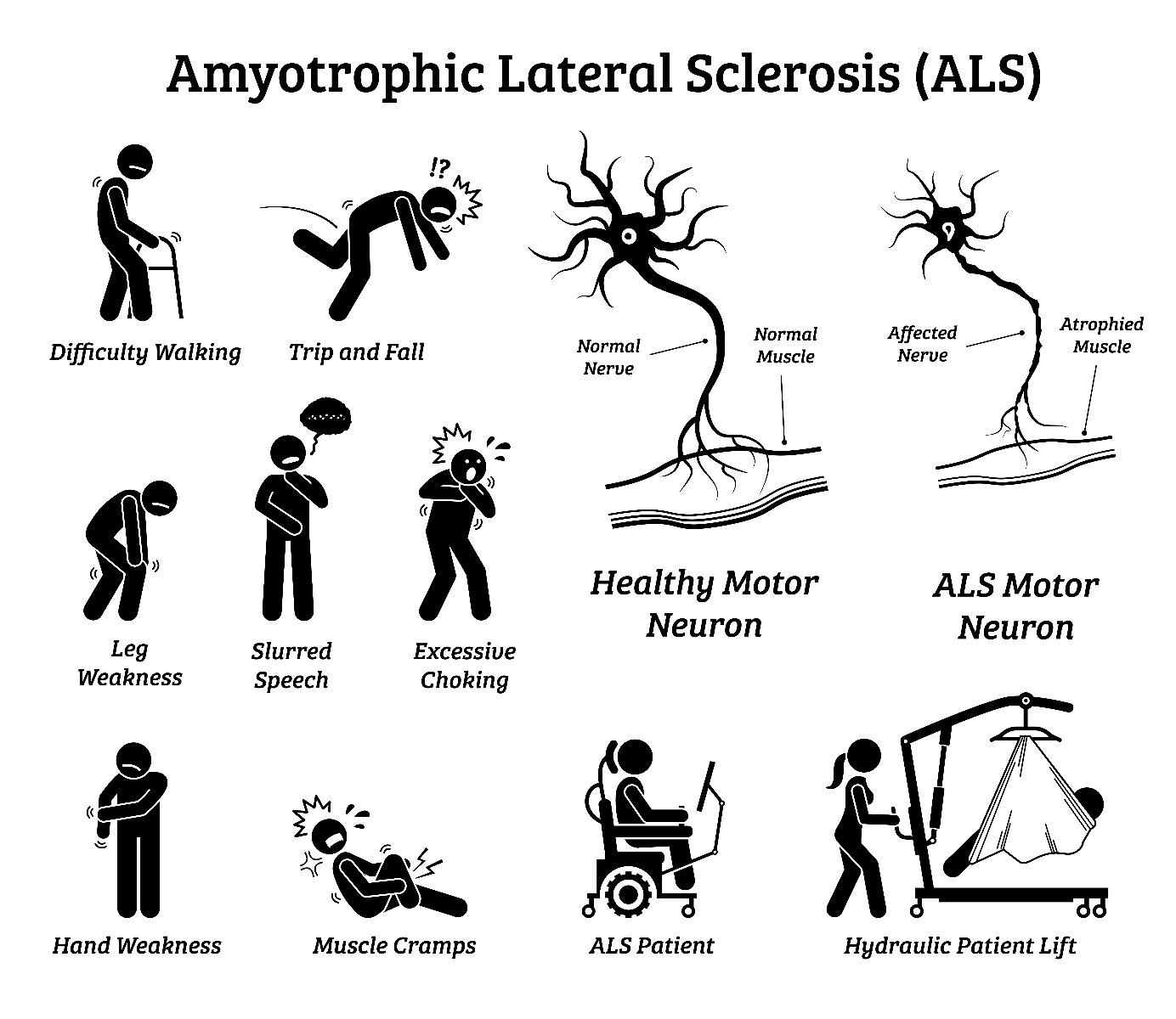 ALS symptoms