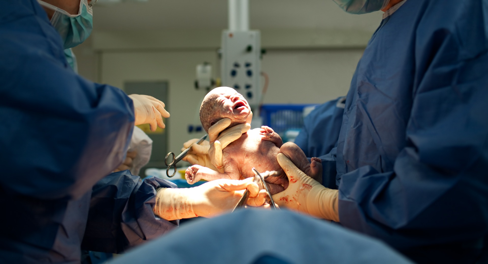 c-section