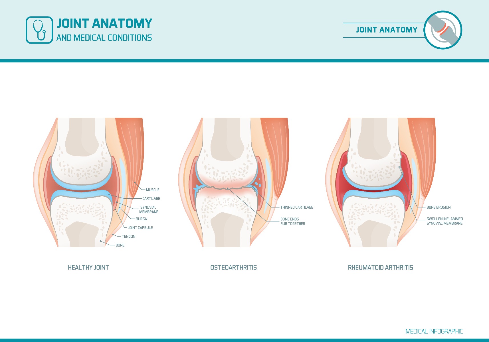 knee joint