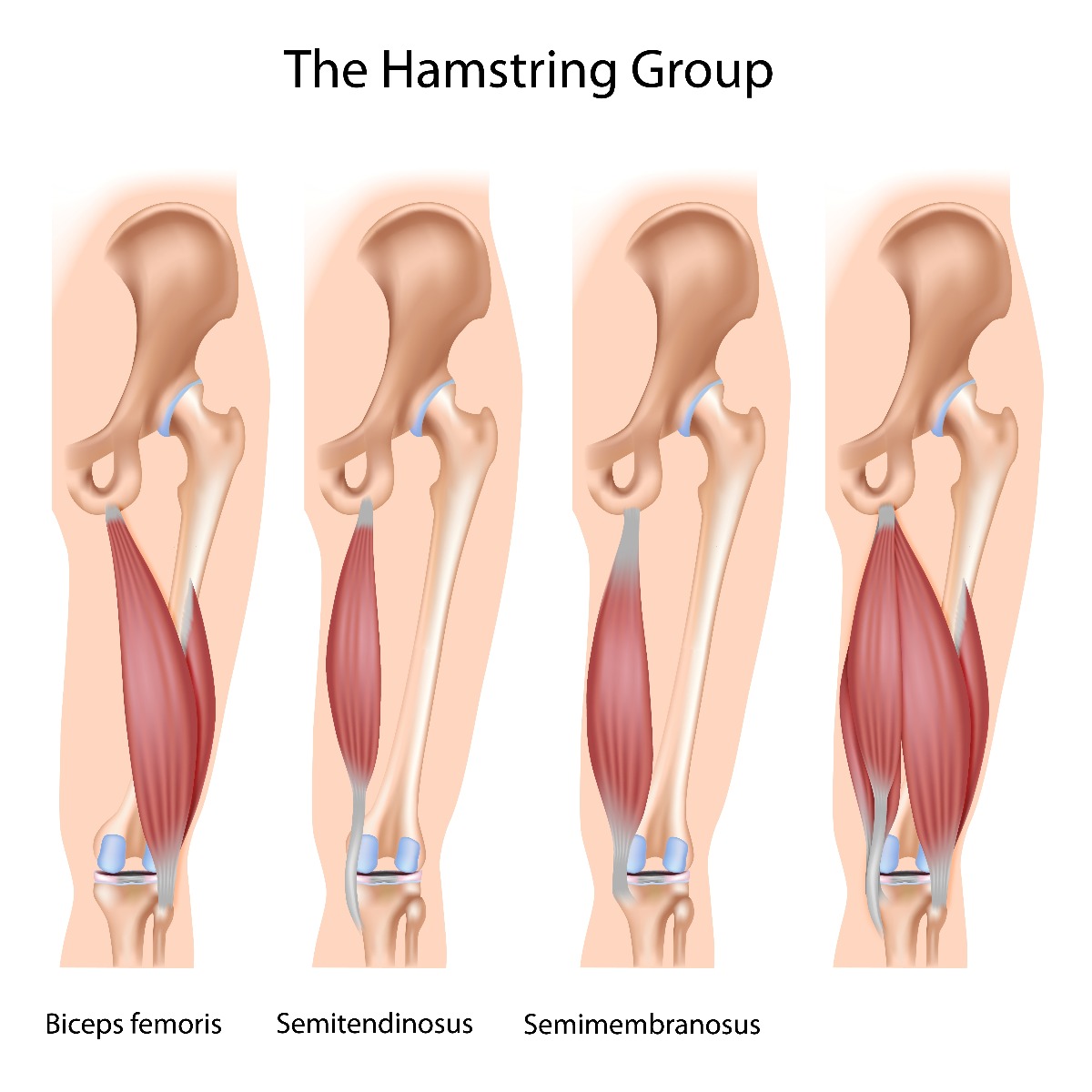 How To Prevent Hamstring Injuries & Avoid A Hamstring Strain