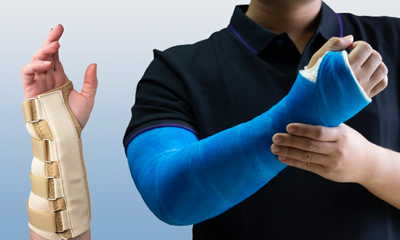 Performance Health | Splinting