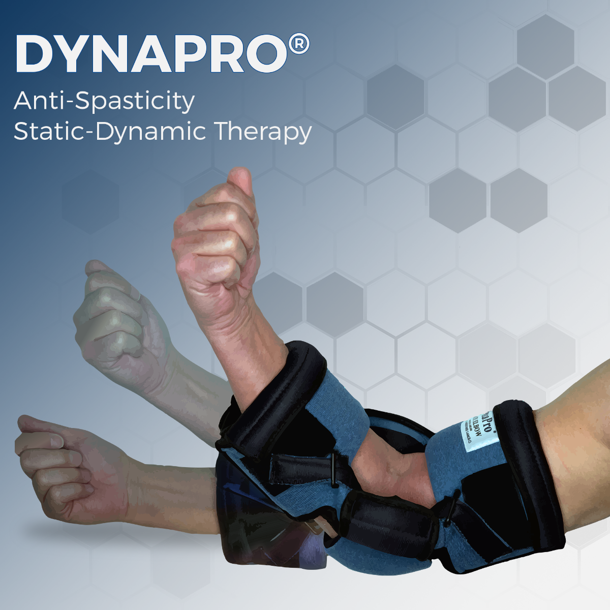 DynaPro