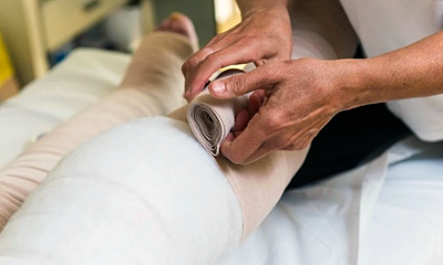 How to Reduce Lymphedema Swelling
